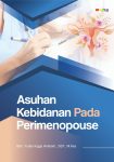Asuhan Kebidanan Pada Perimenopouse