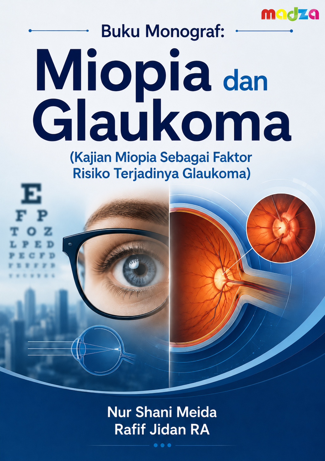 Buku Monograf: Miopia dan Glaukoma (Kajian Miopia Sebagai Faktor Risiko Terjadinya Glaukoma)