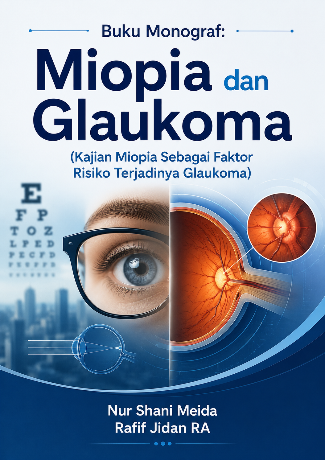 Buku Monograf: Miopia dan Glaukoma (Kajian Miopia Sebagai Faktor Risiko Terjadinya Glaukoma)